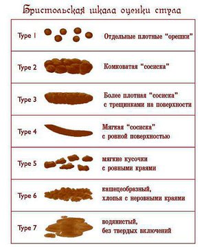 Как правильно кормить кота, чтобы у него не было запоров.