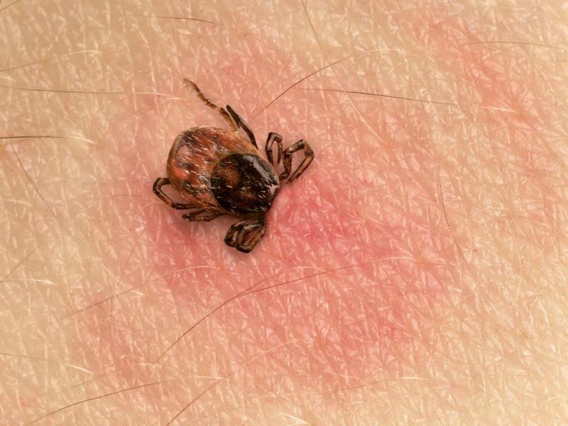 Не дай клещу себя укусить: чем грозят нам маленькие паразиты